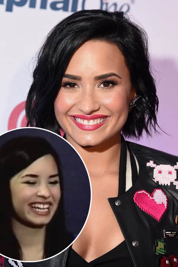 Zahnlücke: Demi Lovato bereut Schönheits-OP