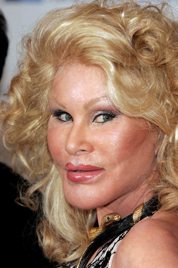 Jocelyn Wildenstein