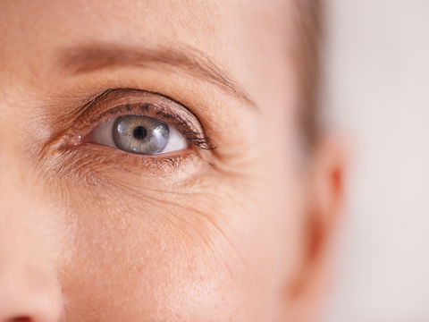 Krähenfüße: Wie die Augenfalten entstehen und was dagegen hilft