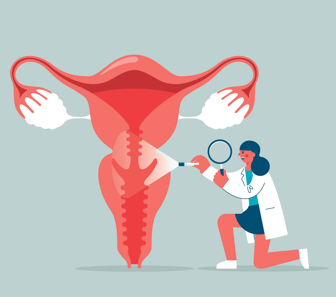 Endometriose: Die unterschätzte Frauenkrankheit