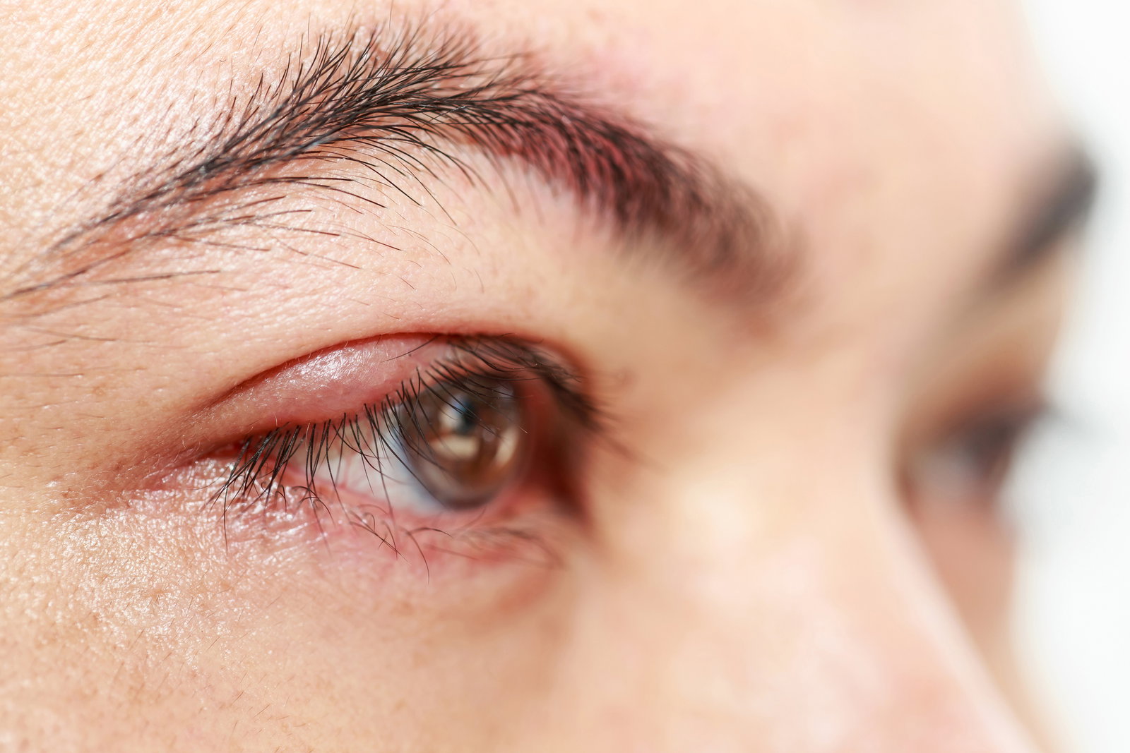 Augenlid innen rot? Hier kommen die 5 besten Tipps und Hausmittel