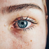 Augen im Stress: Tränende Augen können zum Problem werden
