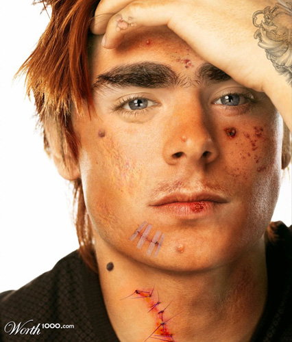 Zac Efron mit Narben