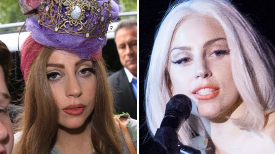 Hatte Lady Gaga eine Nasen-OP?