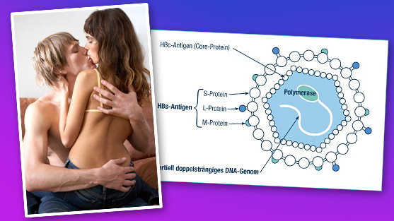 hepatitis-b-schutz-und-impfung-bei-geschlechtskrankheiten-557x313-406330.jpg