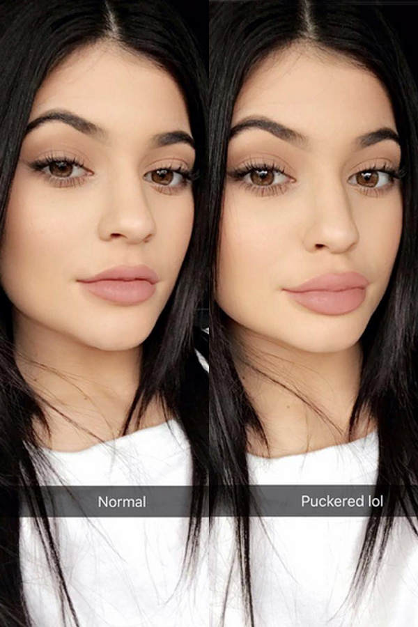 So macht Kylie Jenner ihre Lippen größer