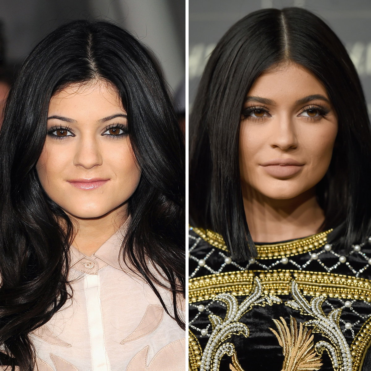 Kylie Jenner Lippen aufspritzen inline