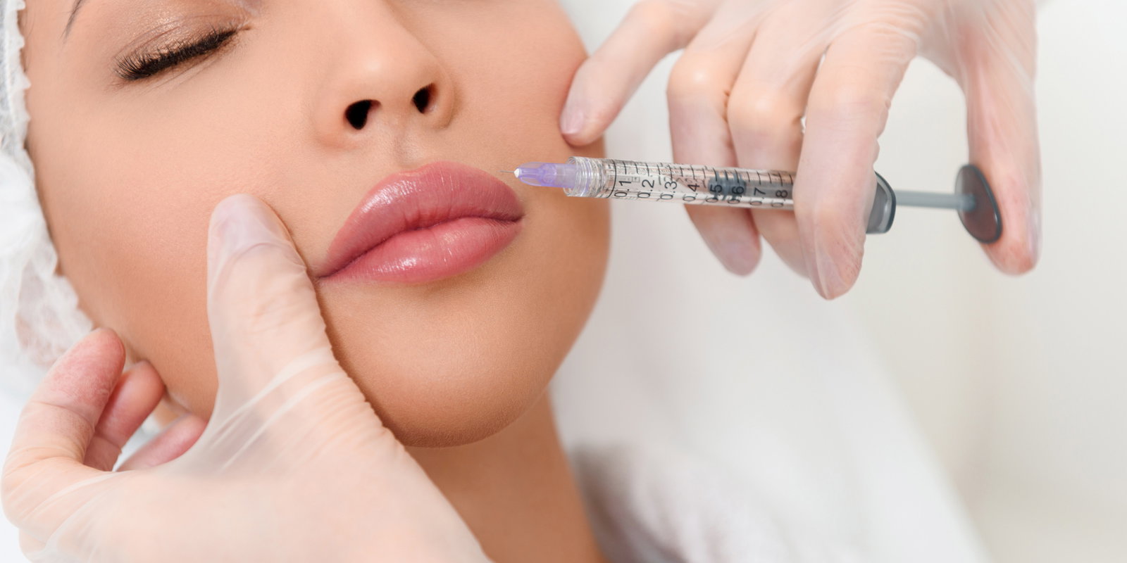 Lippen aufspritzen quer