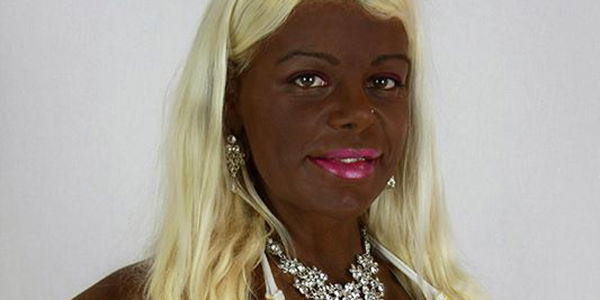 "Schwarze Barbie": Martina Big lässt sich die Haut schwarz spritzen