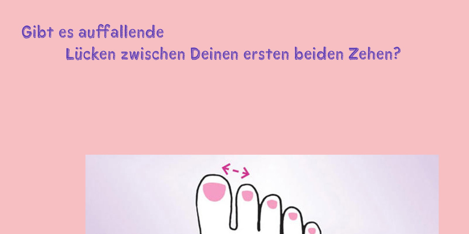 lücken zehen