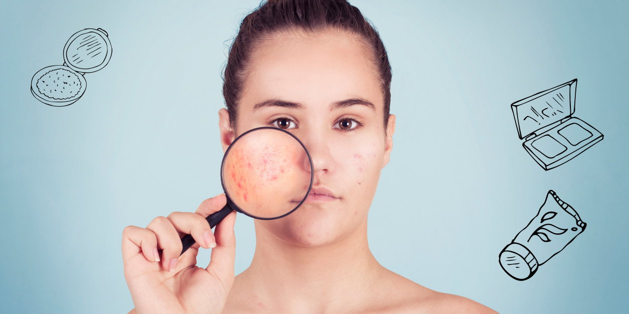 acne-inversa-quer