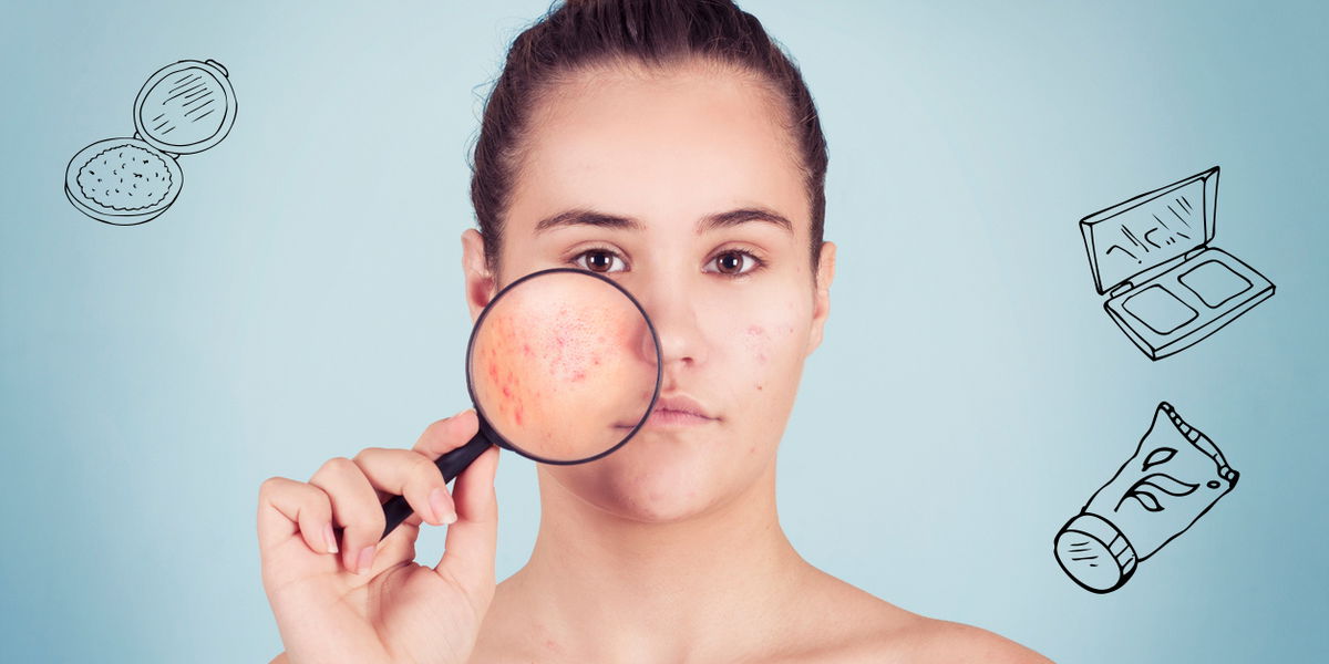Acne inversa: Das wünschst Du nicht mal Deinem größten Feind!